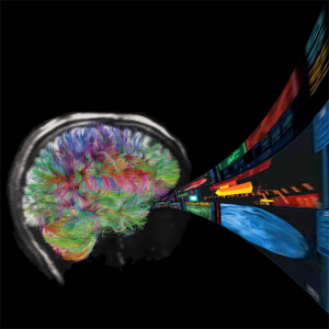 Ifo flowing into a brain